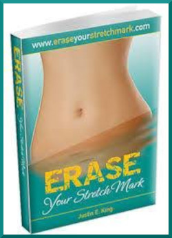 SIDE-Ad-250x346-Erase-Your-Stretch-Marks.jpg